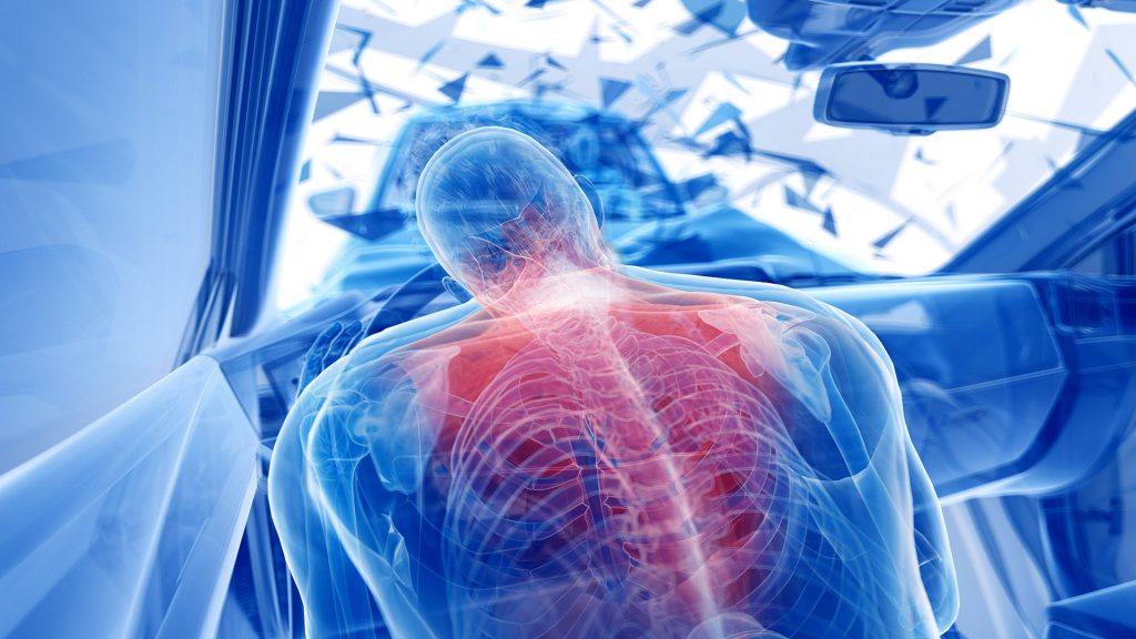 Neck and Back Injury After a Car Accident